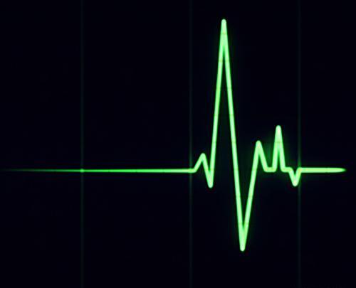 عکس ضربان قلب تموم شده