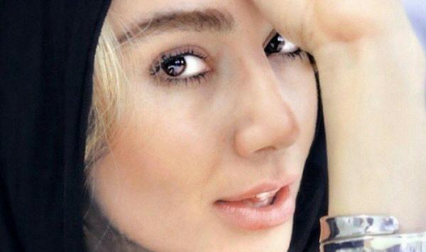 عکس قبل عمل خاطره حاتمی