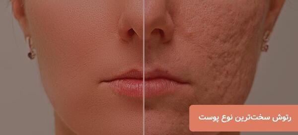 عکس فتوشاپ صورت