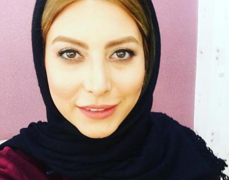 عکس فریبا نادری قبل و بعد از عمل بینی