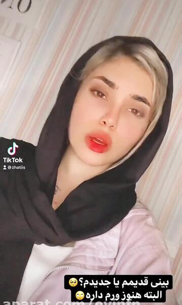 عکس استوری ژاتیس