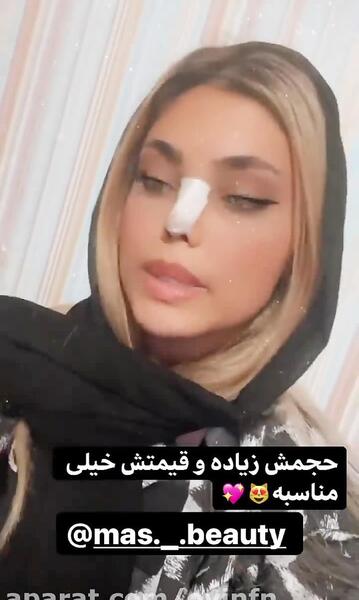 عکس استوری ژاتیس