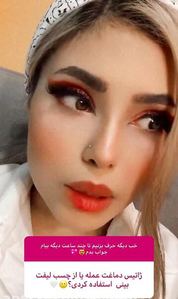 عکس استوری ژاتیس