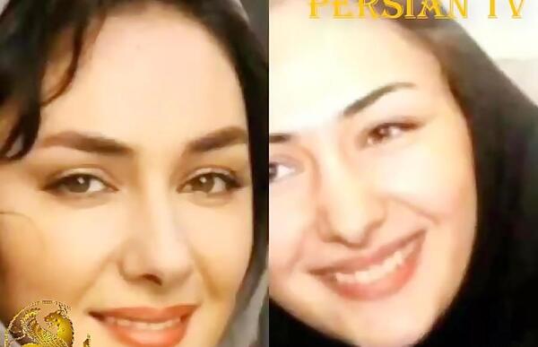 عکس الناز حبیبی قبل از جراحی بینی