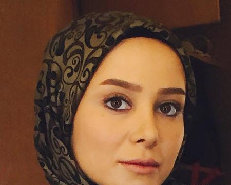 عکس الناز حبیبی قبل از جراحی بینی