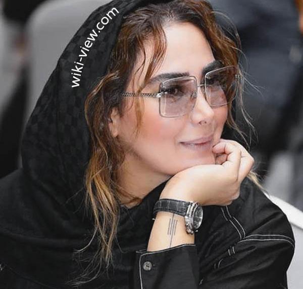 عکسهای انا نعمتی قبل از عمل بینی