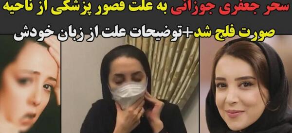 عکس سحر جعفری جوزانی فلج