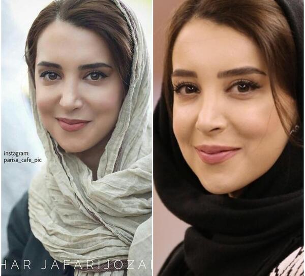 عکس سحر جعفری جوزانی فلج