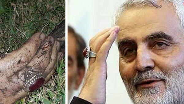 عکس سردار سلیمانی لحظه مرگ