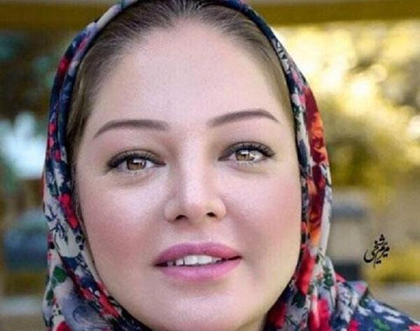 عکس رزیتا غفاری بعد از عمل