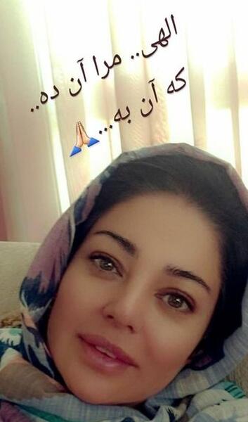 عکس رزیتا غفاری بعد از عمل