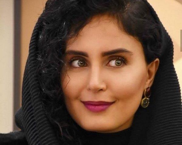 عکس الناز شاکردوست قبل از عمل زیبایی