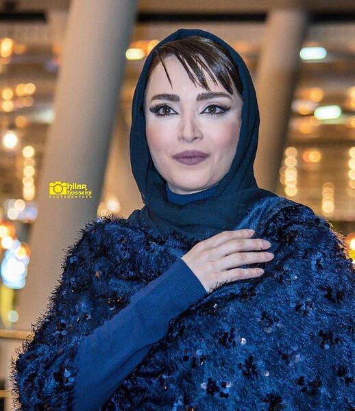 عکس بهنوش طباطبایی قبل و بعد از عمل