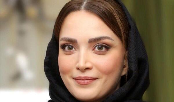 عکس بهنوش طباطبایی قبل و بعد از عمل