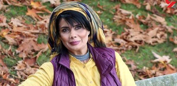 عکس های عاطفه رضوی قبل از عمل بینی