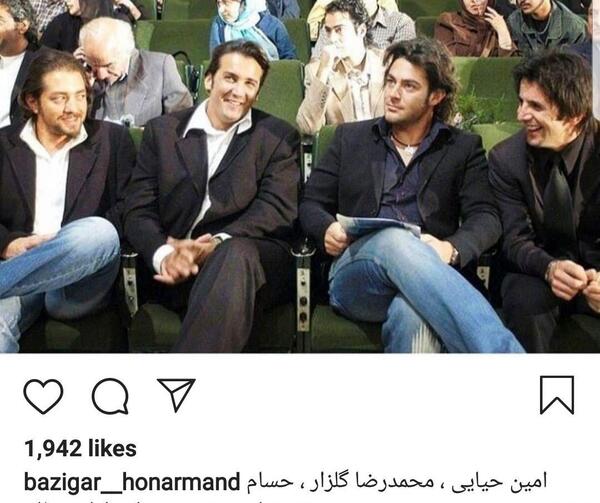 عکس امین حیایی قبل از کاشت مو