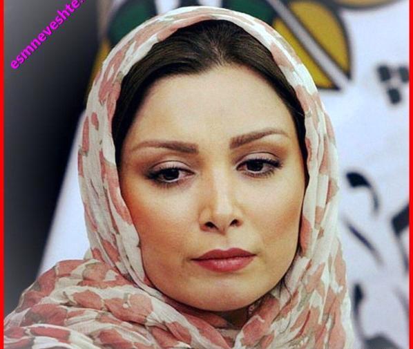 عکس فرناز رهنما قبل از عمل