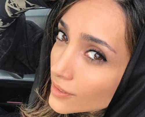 عکس خاطره اسدی قبل از عمل
