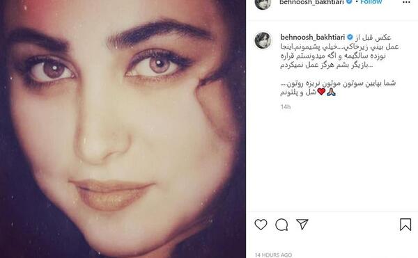 عکس حمیده خیرآبادی قبل از عمل بینی
