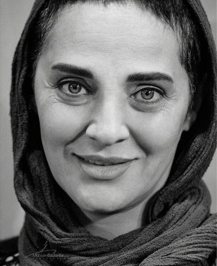 عکس رویا نونهالی کچل
