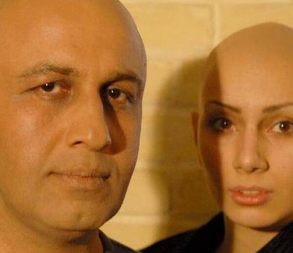 عکس رویا نونهالی کچل