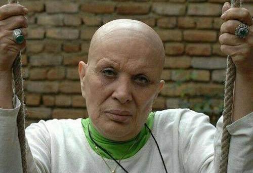 عکس رویا نونهالی کچل
