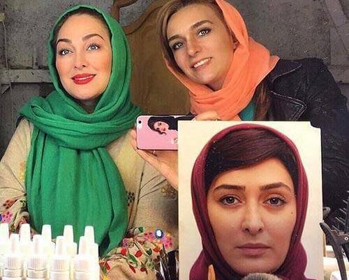 عکس الهام حمیدی قبل عمل