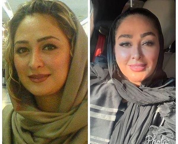 عکس الهام حمیدی قبل عمل