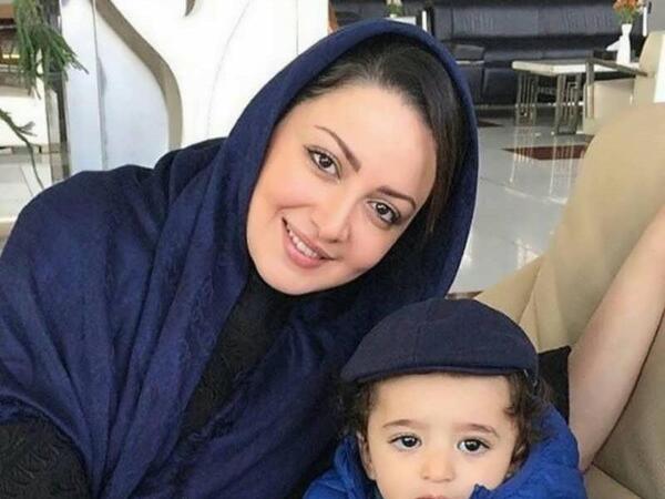 عکس شیلا خداداد بعد از عمل