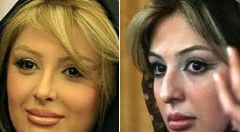 عکس های افسانه پاکرو قبل عمل