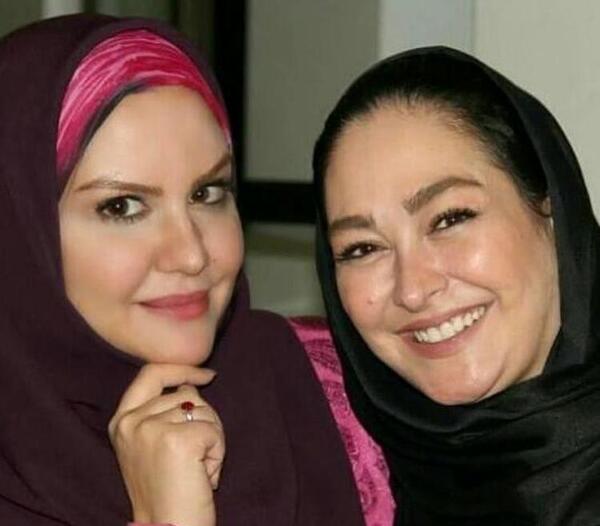 عکس صورت الهام حمیدی