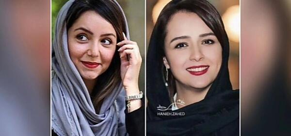 عکس ترانه علیدوستی قبل از عمل بینی