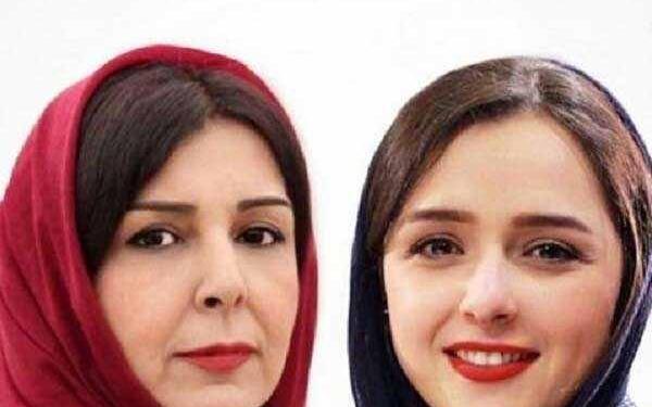 عکس ترانه علیدوستی قبل از عمل بینی