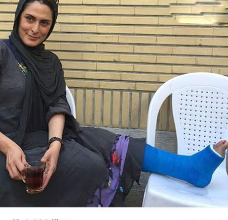 عکس پرستو صالحی با پای شکسته