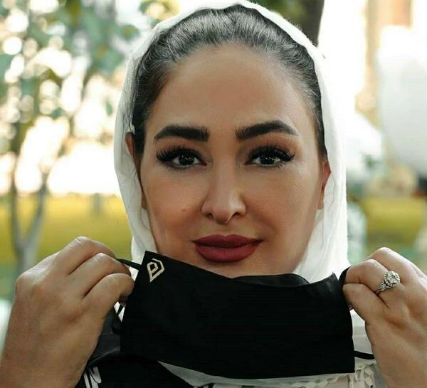 عکس الهام حمیدی قبل عمل بینی