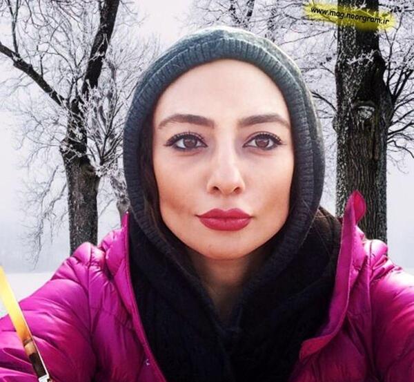 عکس الهام حمیدی قبل عمل بینی