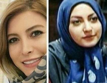 عکس سامیه لک قبل از عمل