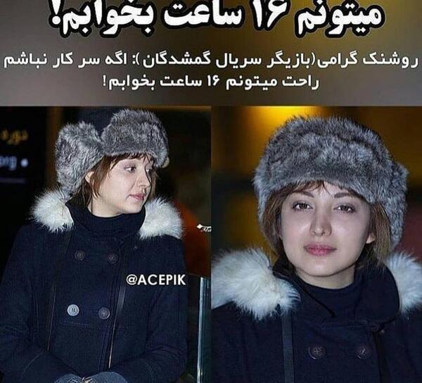 عکس روشنک گرامی قبل از عمل