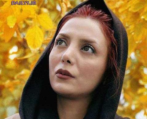 عکس رویا میرعلمی قبل از عمل بینی