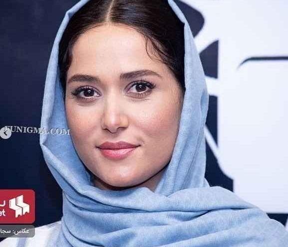عکس پریناز ایزدیار قبل عمل