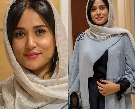 عکس پریناز ایزدیار قبل عمل