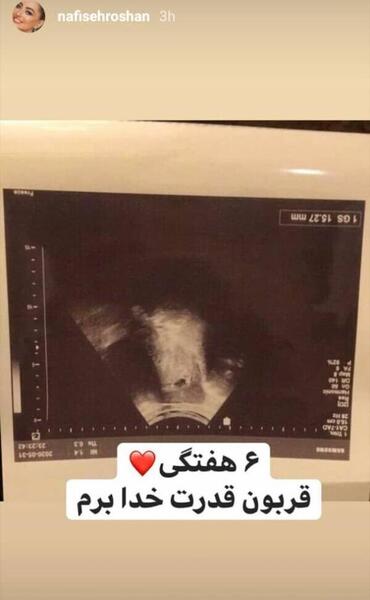 عکس حاملگی شبنم مقدمی