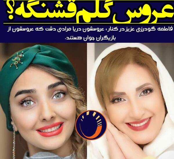 عکس فاطمه گودرزی قبل از عمل زیبایی