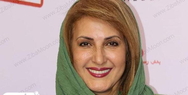 عکس فاطمه گودرزی قبل از عمل زیبایی