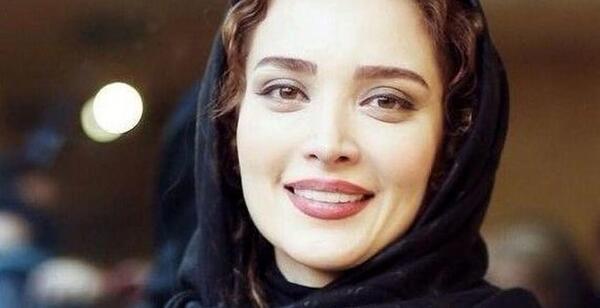 عکس بهنوش طباطبایی قبل از عمل