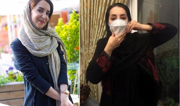 عکس سحر جعفری جوزانی قبل عمل بینی