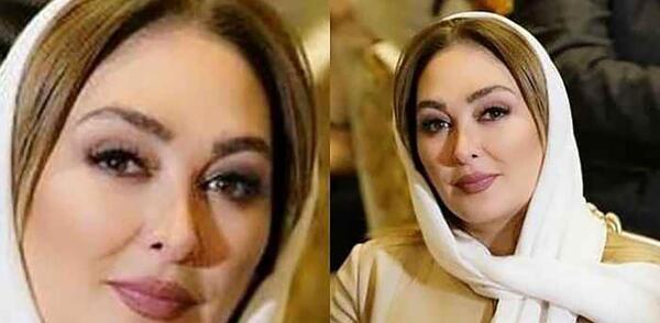 عکس قبل از عمل الهام حمیدی