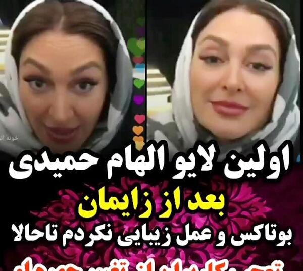 عکس قبل از عمل الهام حمیدی