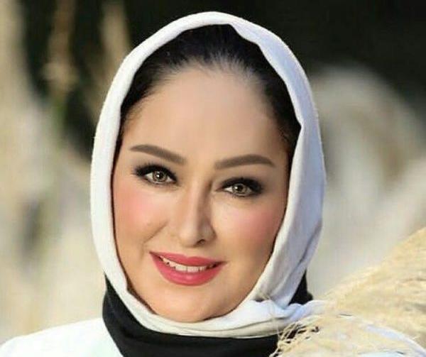 عکس قبل از عمل الهام حمیدی