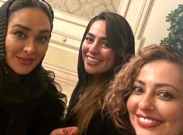 عکس قبل از عمل الهام حمیدی